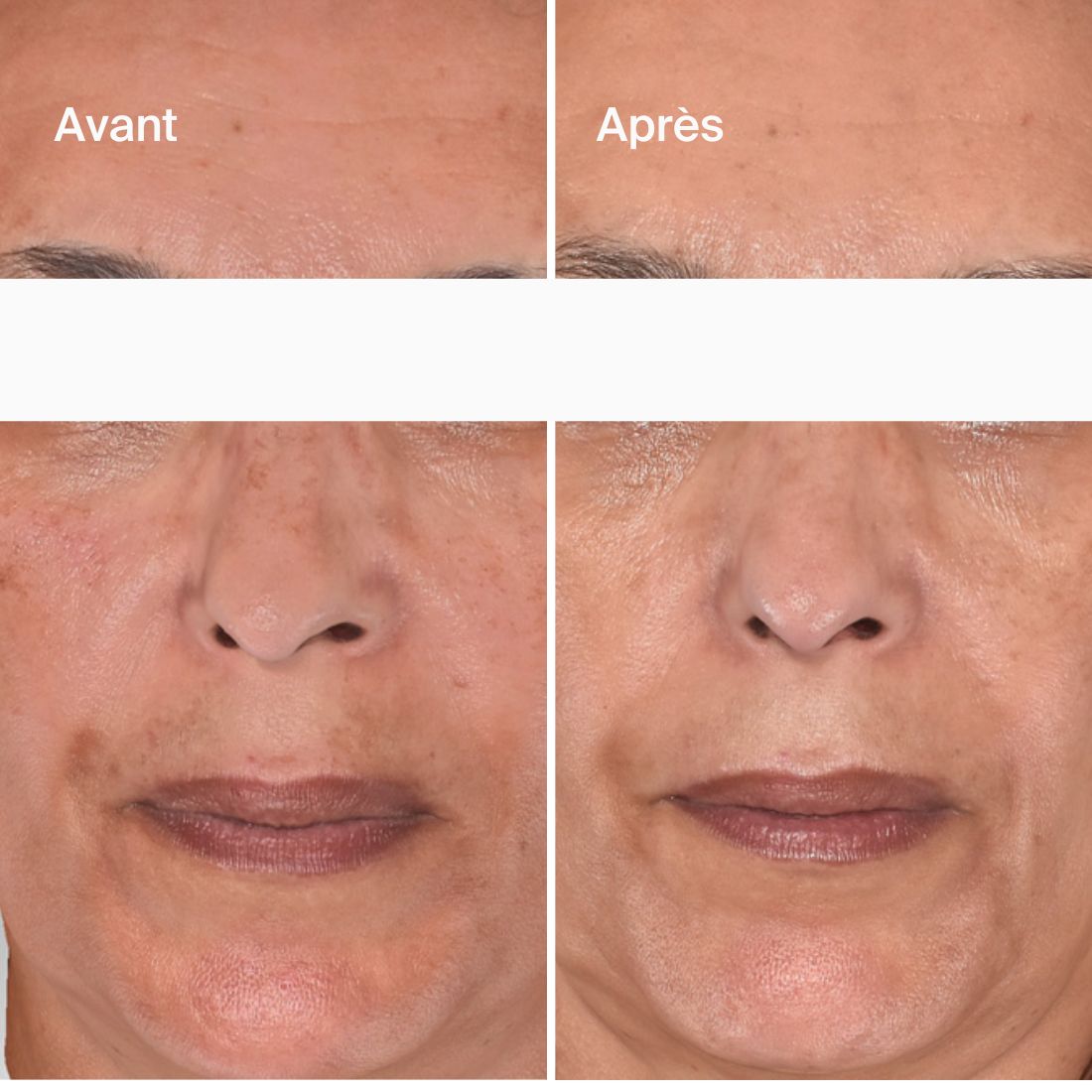 Éclat - Acide Hyaluronique + Safran