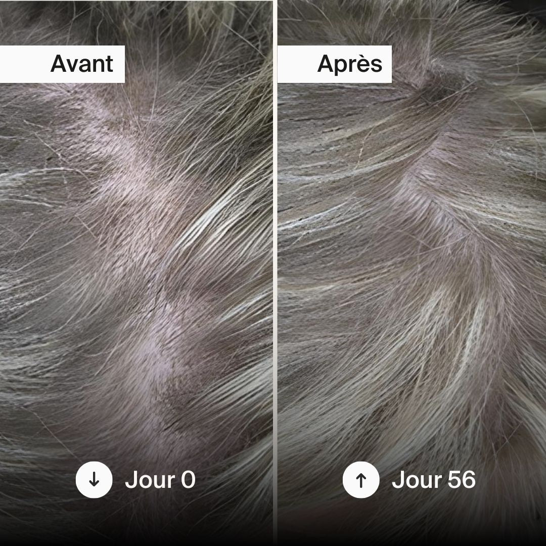 Gummies Cheveux